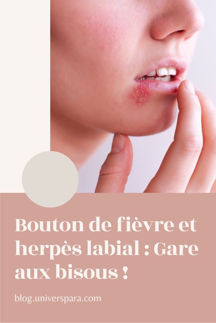 Bouton de fièvre et herpès labial gare aux bisous