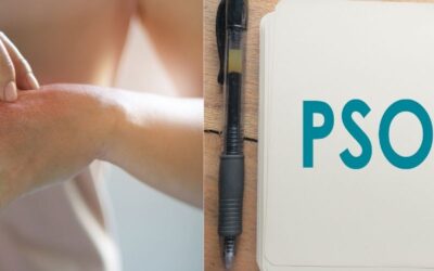 Le psoriasis en 5 infos clés